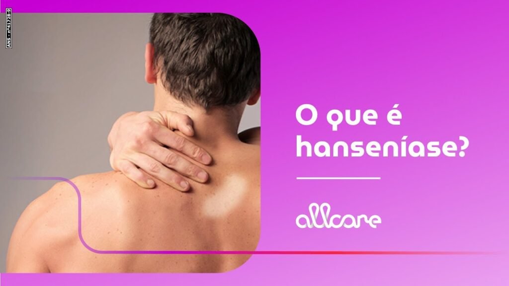 Hanseníase tem cura! Conheça os sintomas – Planos de Saúde e Seguros